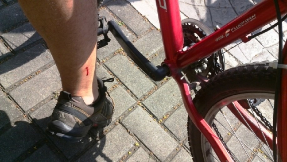 Trip photo #16/21 Just a small flesh wound from the pedals